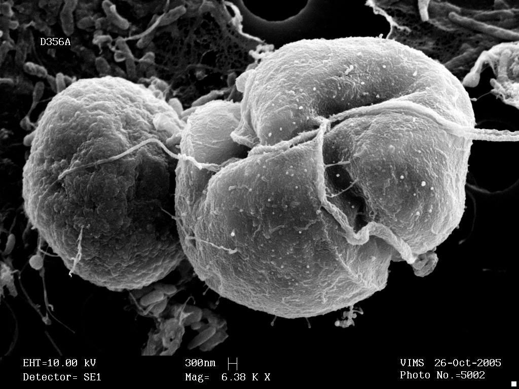 This scanning electron micrograph shows a Karlodinium veneficum cell, at right, attached to a prey cryptophyte in the process of ingestion. Image Credit: Vince Lovko.