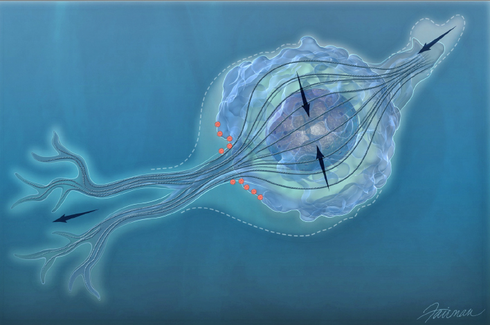 Top image depicts a cancer cell crawling atop a flat lab dish in the way cancer cell movement has traditionally been studied. Bottom image shows a cancer cell traveling through a 3D matrix that more closely resembles the environment through which cancer cells move in a human body. Researchers in the new Johns Hopkins Physical Sciences-Oncology Center will utilize this 3D tracking process. Images by Jennifer E. Fairman, assistant professor in the Johns Hopkins School of Medicine’s Department of Art as Applied to Medicine . 