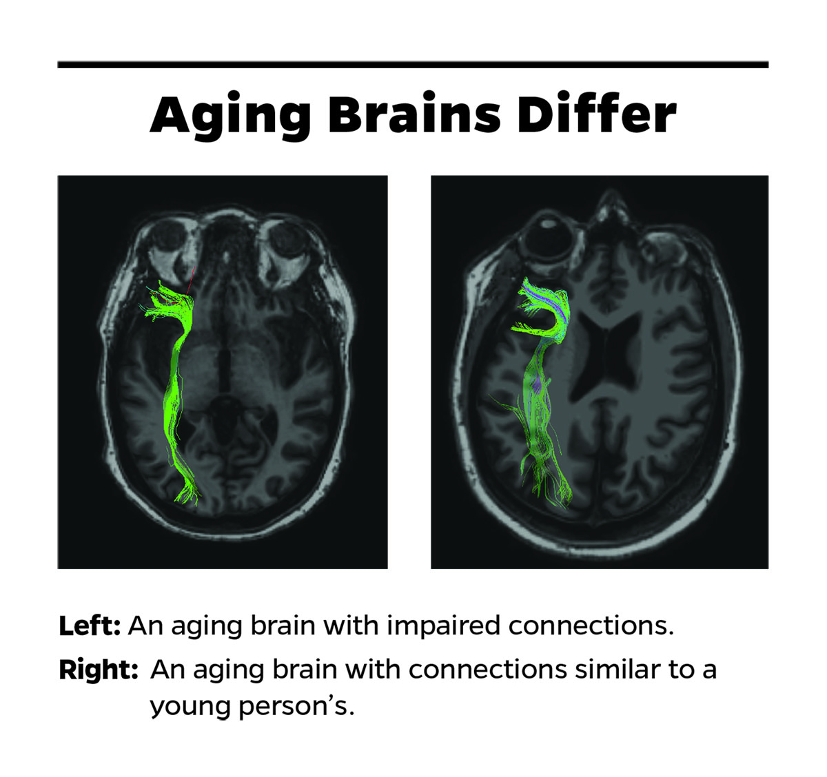 JHU: How Some Older Brains Decline Before People Realize It « News From ...