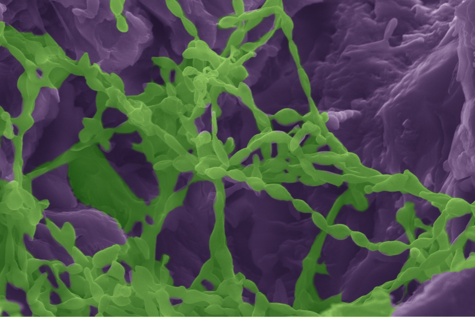 Life on the Rocks Helps Scientists Understand How to Survive in Extreme Environments « News from